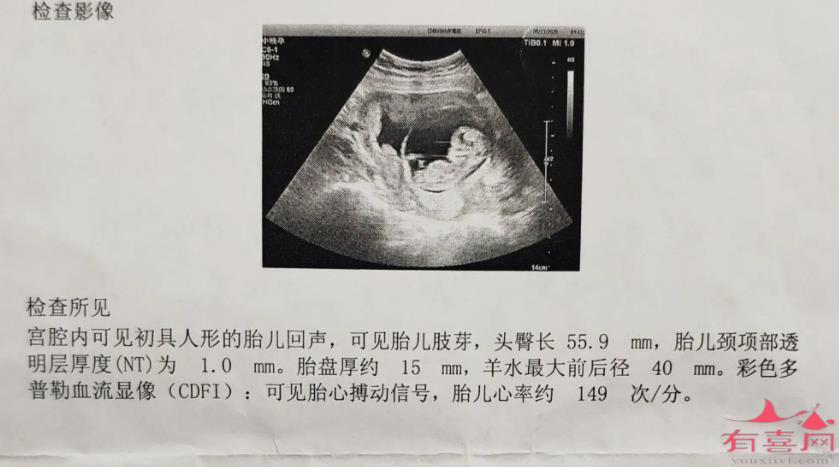 周口助孕宝宝医院-12周能看出宝宝的性别吗？(图1)