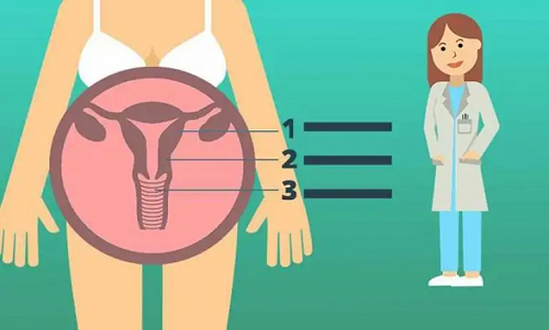 宁波56岁供卵试管助孕-如果我的卵巢功能不好，我可以做试管婴儿吗？(图1)
